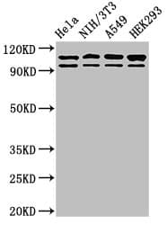 Polyclonal Rabbit anti-Human MSH2 Antibody (WB)