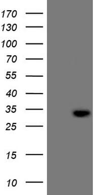 C21orf62 Antibody (clone OTI4A6)