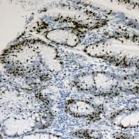 HNF4 Alpha+Gamma Antibody (Internal)