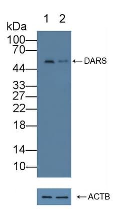 DARS Antibody