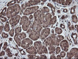 Monoclonal Mouse anti-Human PNPO Antibody (clone OTI1G9, IHC, WB)