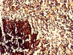 CD79A / CD79 Alpha Antibody