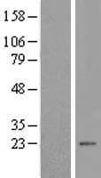 MCTS1 Protein (Over-Expression Lysate Myc-DDK (Flag))