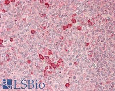 IHC-plus™ HSP90B1 / GP96 / GRP94 Antibody (aa 27-799)