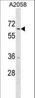 TRIM35 Antibody (aa434-463)