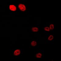AR / Androgen Receptor Antibody (phospho-Ser213)