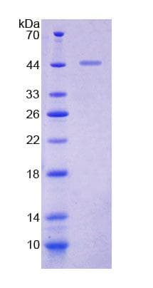 Human AGL Protein (Recombinant His-T7, N-terminus)