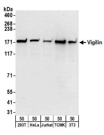 RELA / NFKB p65 Antibody (aa501-551)