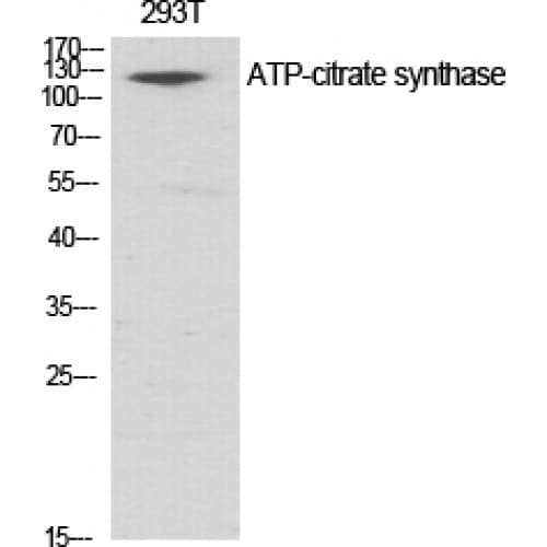 ACLY / ATP Citrate Lyase Antibody (390-470 aa)