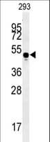 MYLK4 Antibody (aa286-314)
