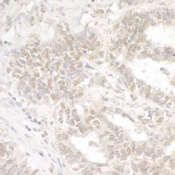 EHMT2 / G9A Antibody (aa1160-C-term)