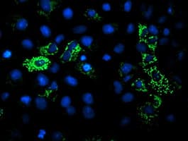 DLD / Diaphorase / E3 Antibody (clone OTI5G7)