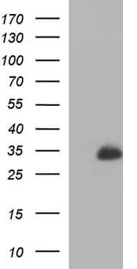 MBL2 / Mannose Binding Protein Antibody (clone OTI2G5, Carrier-free)
