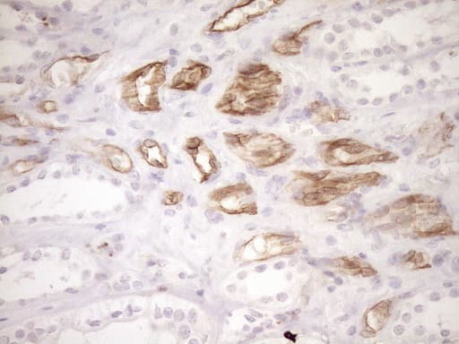 Monoclonal Mouse anti-Human BLNK Antibody (clone OTI4C9, aa1-292, IHC, WB)