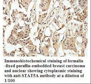 STAT5A Antibody (aa562-774)