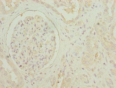 GDF15 Antibody