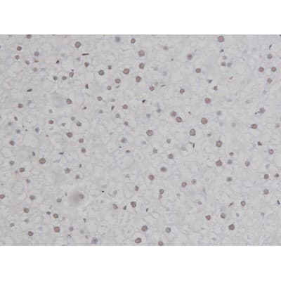 Polyclonal Rabbit anti-Human CHUK / IKKA / IKK Alpha Antibody (phospho-Ser180,phospho-Ser181, IHC, IF, WB)