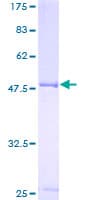 Human PEA3 / ETV4 Protein (Recombinant GST)