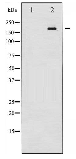 RET Antibody (phospho-Tyr1062)