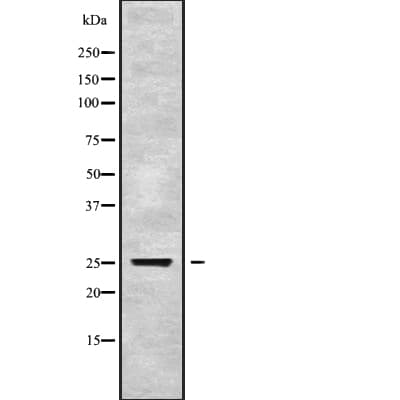 Polyclonal Rabbit anti-Human GH / Growth Hormone Antibody (WB)