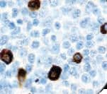 Mouse Anti-Human IgA Secondary Antibody (Ready-to-Use)