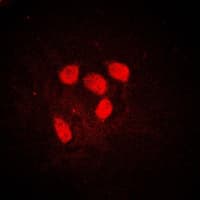 MYC / c-Myc Antibody (phospho-Ser62)