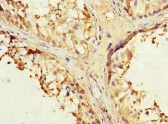 CRF2-12 / IL28RA Antibody