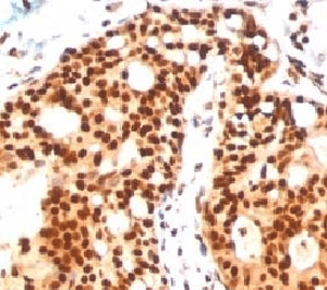 SUMO2 + SUMO3 Antibody (clone SM23/496, Ready-to-Use)