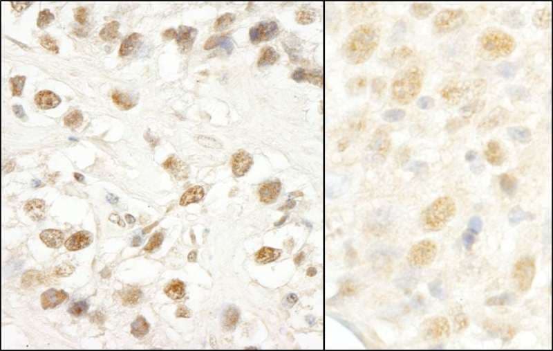 Polyclonal Rabbit anti-Human LUC7L3 / CROP Antibody (aa1-50, IHC)