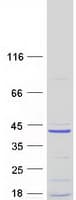 Human C11orf74 Protein (Recombinant Myc-DDK (Flag))