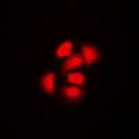 TRIP4 / ASC-1 Antibody (Internal)