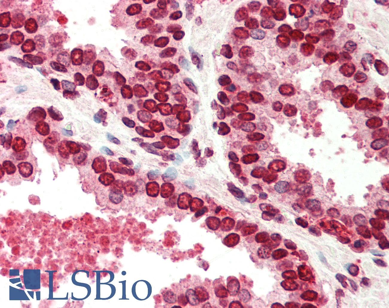 IHC-plus™ BANF1 / BAF / BCRP1 Antibody