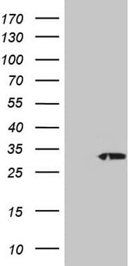 Monoclonal Mouse anti-Human TNFSF5IP1 / CLAST3 Antibody (clone OTI3F1, IHC, WB)