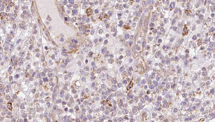 Cnpy2 / TMEM4 Antibody