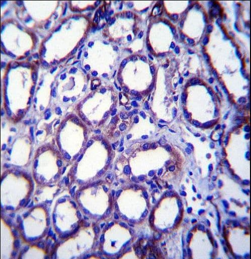 TRIM34 / RNF21 Antibody (aa67-96)