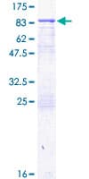 Human TGM2 / Transglutaminase 2 Protein (Recombinant GST)