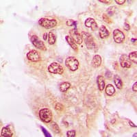 NFKB1 / NF-Kappa-B Antibody (C-Terminus)