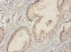TROVE2 Antibody