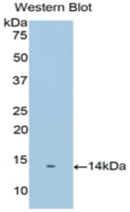 PSCA Antibody (aa22-123)