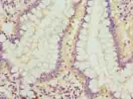 LRRC42 Antibody