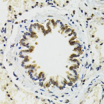 TIP48 / RUVBL2 Antibody