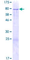 Human ZNF213 Protein (Recombinant GST)