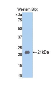MMP13 Antibody (aa70-245)