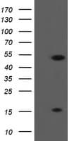 Monoclonal Mouse anti-Human ALX4 Antibody (clone OTI2F2, WB)