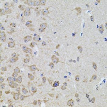 CCN5 Antibody