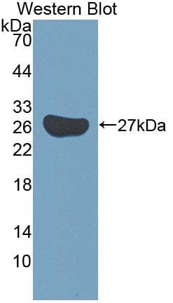 Polyclonal Rabbit anti-Mouse KATNA1 Antibody (Cy3, aa260-491, WB)