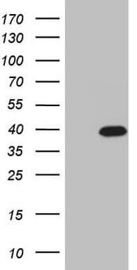 Monoclonal Mouse anti-Human CABP4 Antibody (clone OTI9A7, WB)