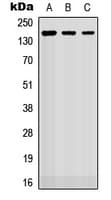 Polyclonal Rabbit anti-Human ROBO2 Antibody (Internal, WB)