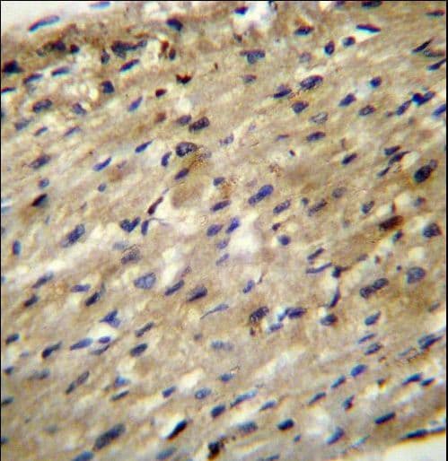 Polyclonal Rabbit anti-Human ABCD2 / ALDR Antibody (aa553-582, IHC, WB)