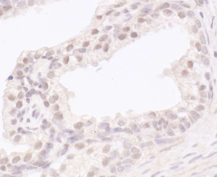 Polyclonal Rabbit anti-Human UBR5 Antibody (aa600-650, IHC, WB)